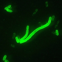 Le virus de la peste peut survivre plusieurs années dans des endroits sans oxygène