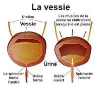 Rétention urinaire : symptômes et définition