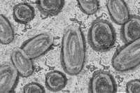 Des pustules apparaissent chez les personnes atteintes de la variole du singe.