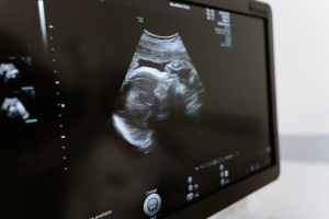 Le résultat d&#039;une échographie de grossesse. 