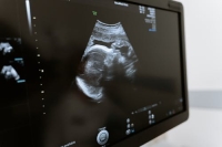 Le résultat d'une échographie de grossesse. 