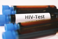 Il n’existe pas de données précises sur les interactions entre VIH et Covid-19