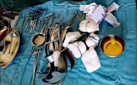 Des instruments de chirurgie utilisés en gynécologie